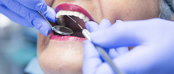Best Emergency Dentist for Knocked-Out Tooth in Mount Kisco, NY
